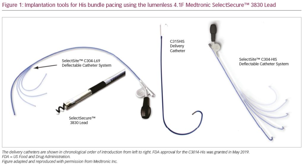 His Bundle Pacing – Why Should You be Doing it? – touchCARDIOLOGY