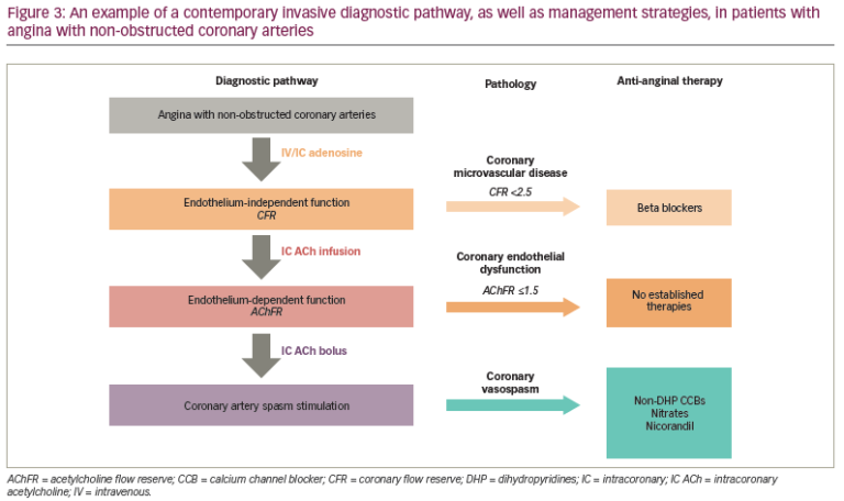 Vasospastic Angina: A Contemporary Review of its Pathophysiology ...