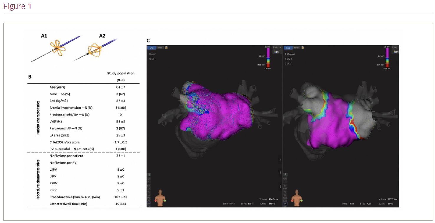 77 Procedural Safety And Acute Effectiveness Of Pulsed Field Ablation For Treatment Of Atrial