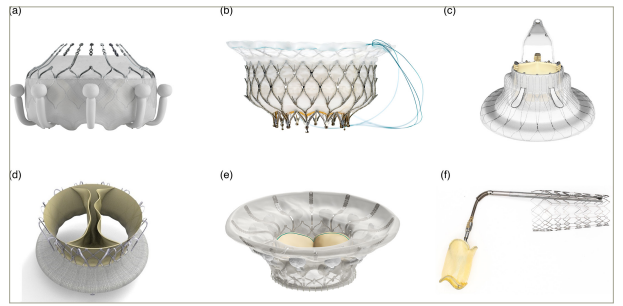 Figure 2: Transcatheter tricuspid valve replacement systems