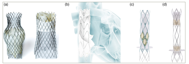 Figure 3: Transcatheter heterotopic caval valve implantation systems