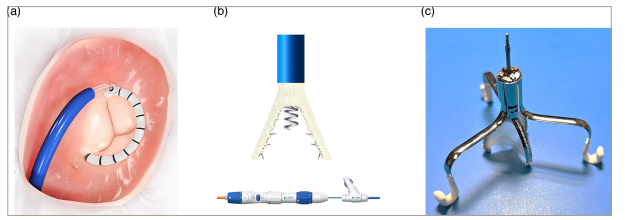 Figure 4: Transcatheter tricuspid annuloplasty devices