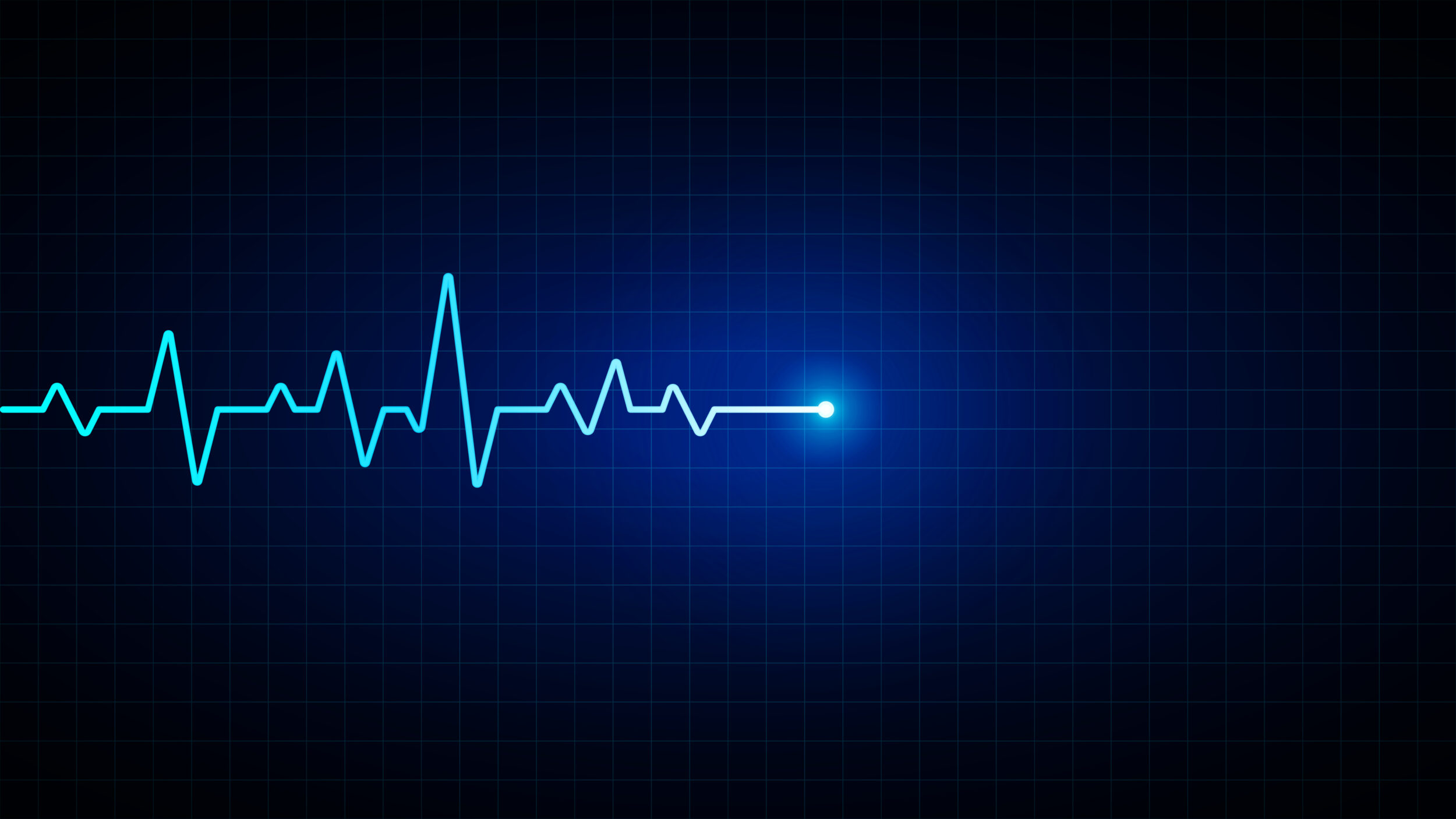 Electrocardiogram line, EKG heartbeat rhythm display on a medical monitor, illuminated by blue neon light against a dark grid, representing a health concept.