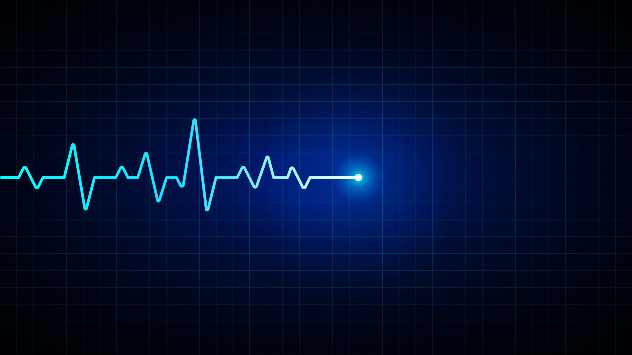 Electrocardiogram line, EKG heartbeat rhythm display on a medical monitor, illuminated by blue neon light against a dark grid, representing a health concept.